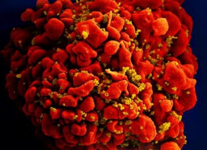 Virus HIV se učí odolávat jedinému léku