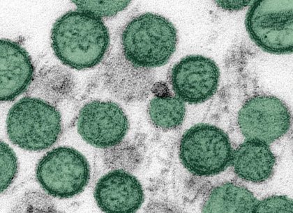 Není hantavirus jako hantavirus. Některé druhy jsou i v tuzemsku